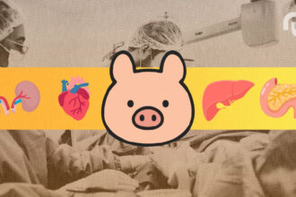 Cochon Greffe Porc Transplantation.jpg